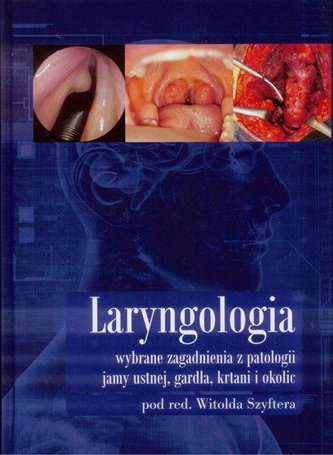 Laryngologia wybrane zagadnienia