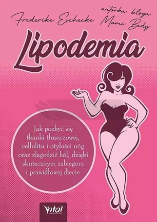 Lipodemia