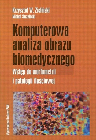 Komputerowa analiza obrazu biomedycznego