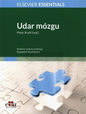 Udar mózgu