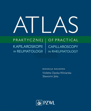 Atlas praktycznej kapilaroskopii w reumatologii