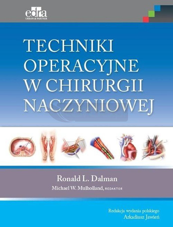 Techniki operacyjne w chirurgii naczyniowej