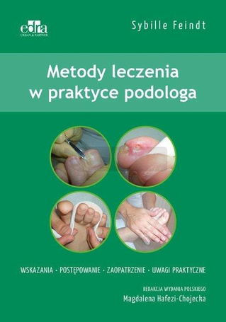 Metody leczenia w podologii