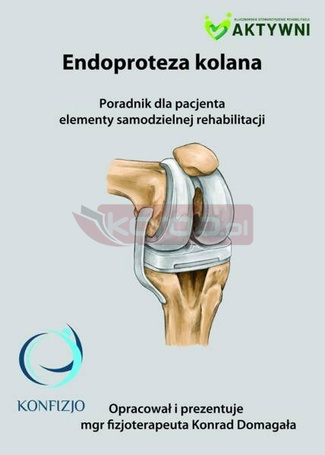 Endoproteza kolana. poradnik dla pacjenta..