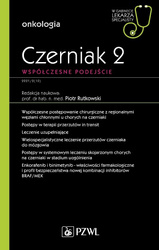 Czerniak. Współczesne podejście 2. W gabinecie ...