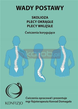 Wady postawy. Skolioza, plecy okrągłe, plecy wklęs