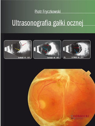 Ultrasonografia gałki ocznej