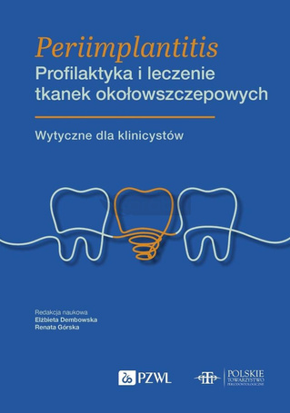 Periimplantitis. Profilaktyka i leczenie tkanek...