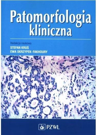 Patomorfologia kliniczna