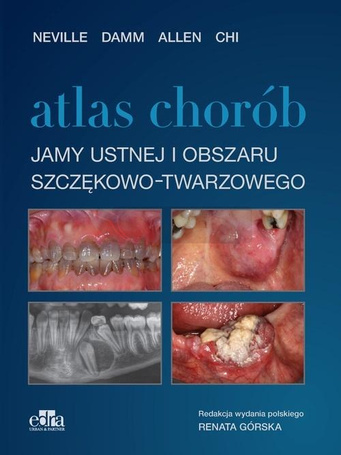 Atlas chorób jamy ustnej i obszaru szczękowo..