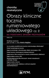 Obrazy kliniczne tocznia rumieniowatego układ cz.2