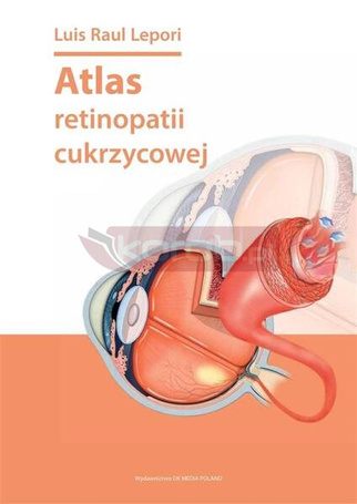 Atlas retinopatii cukrzycowej