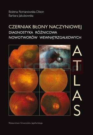 Czerniak błony naczyniowej. Diagnostyka różnicowa