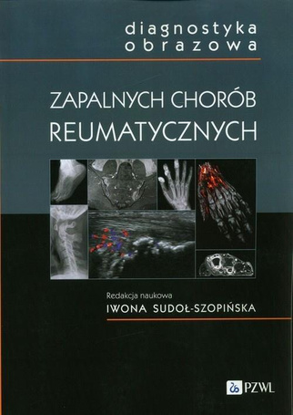 Diagnostyka obrazowa zapalnych chorób..