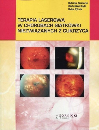 Terapia laserowa w chorobach siatkówki...