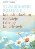 Stwardnienie rozsiane