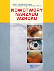 Nowotwory narządu wzroku