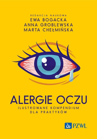 Alergie oczu. Ilustrowane kompendium dla praktyków