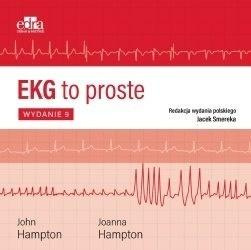 EKG to proste