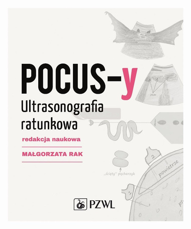 POCUS-y. Ultrasonografia ratunkowa