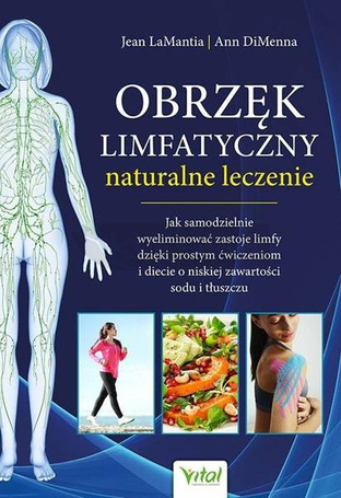 Obrzęk limfatyczny - naturalne leczenie
