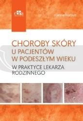 Choroby skóry u pacjentów w podeszłym wieku