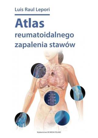 Atlas reumatoidalnego zapalenia stawów